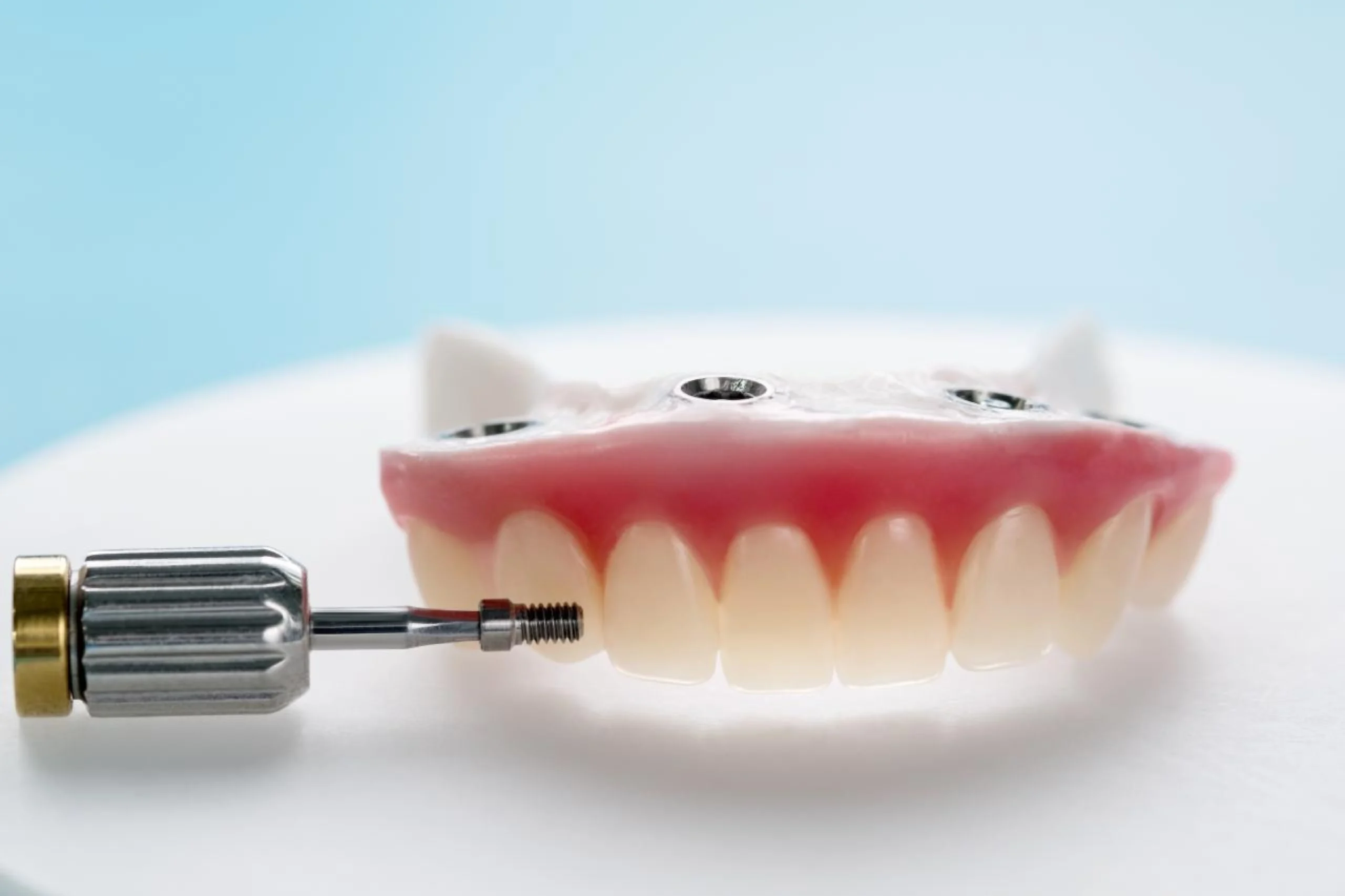 implant supported restorations near you