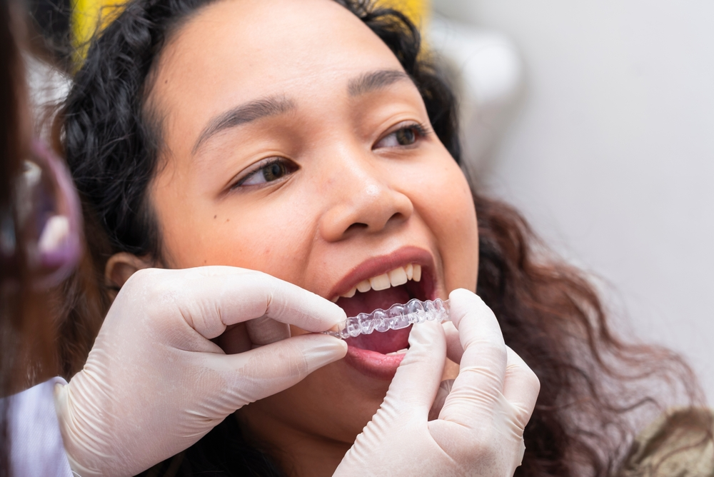 invisalign in marpole vancouver