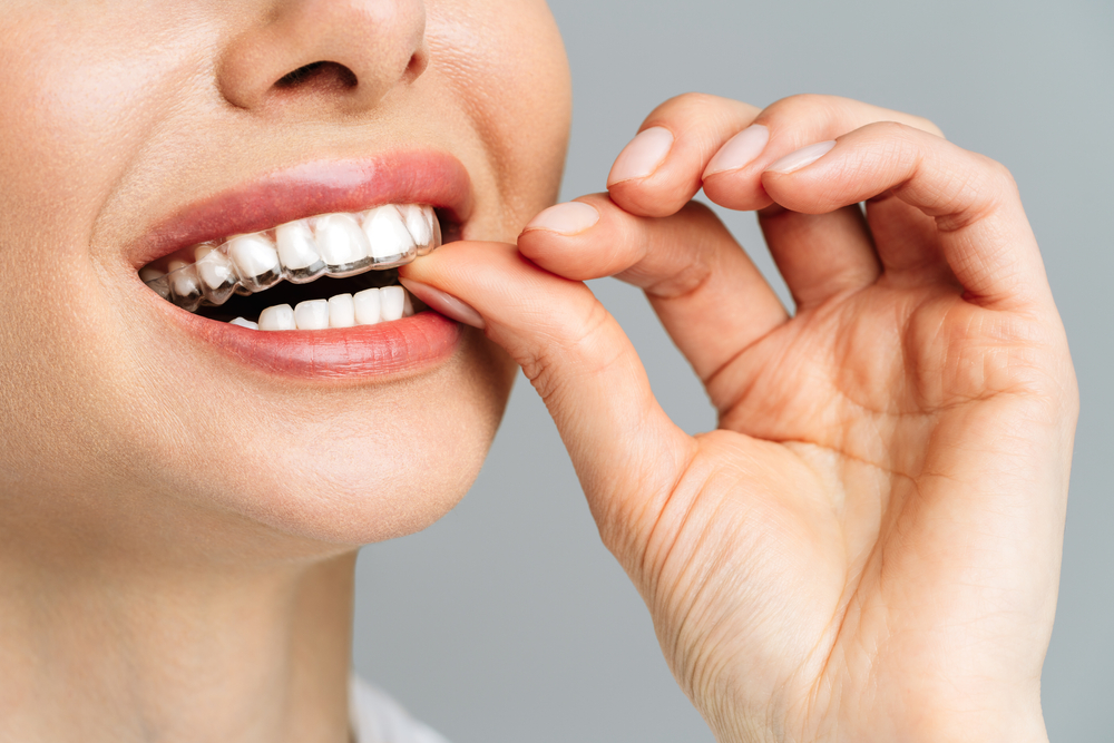 orthodontics in marpole vancouver