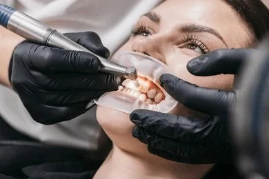 professional teeth cleanings near you