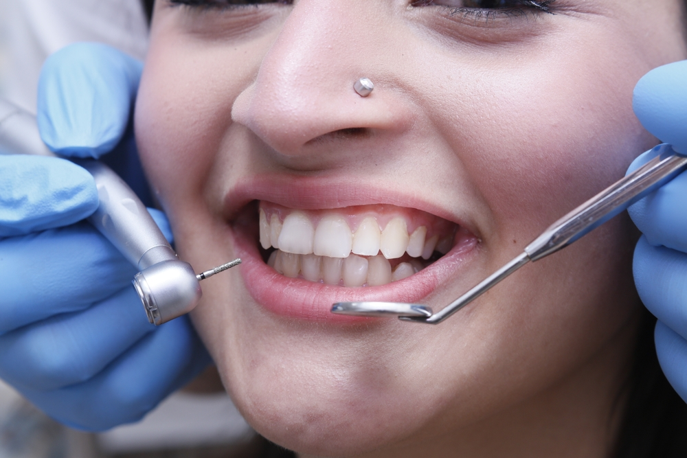 smile enhancements in marpole vancouver
