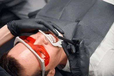 teeth whitening in marpole vancouver