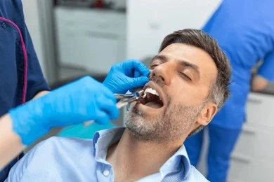 tooth extractions in marpole vancouver