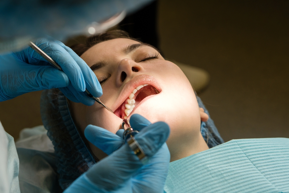 wisdom teeth removal in marpole, vancouver